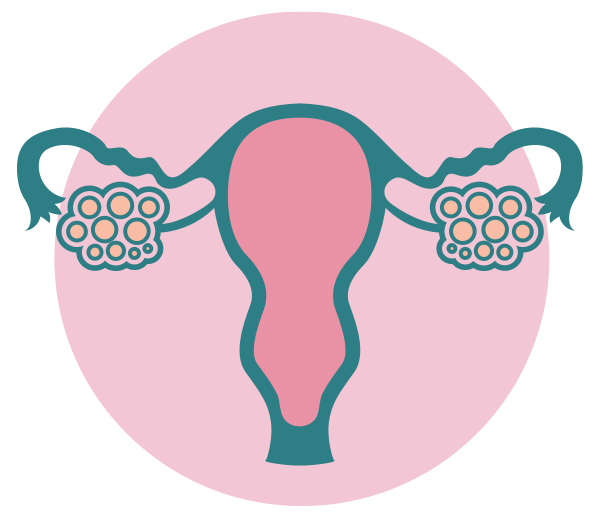 PCOS
